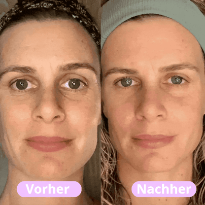 Celaru - Straffendes LED-Gesichtsmassagegerät